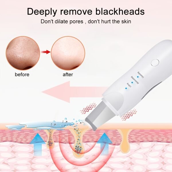 Ultrasonic Skin Scrubber Deep Face Cleaning Machine Peeling Shovel Facial Pore Cleaner Face Skin Scrubber Lift Beauty Instrument - Image 3
