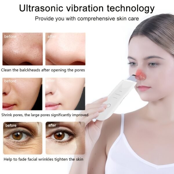 Ultrasonic Skin Scrubber Deep Face Cleaning Machine Peeling Shovel Facial Pore Cleaner Face Skin Scrubber Lift Beauty Instrument - Image 5